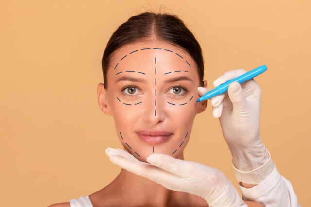 cheek implants