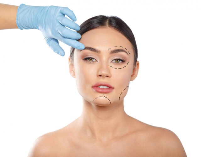cheek implants