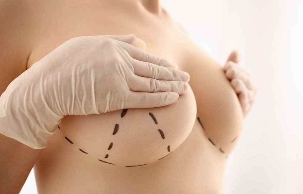 Breast Reduction Surgery in Punjab 2025– What You’re Not Being Told