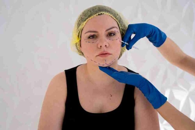  Plastic Surgery in India