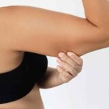 top-rated arm lift surgery in Chandigarh